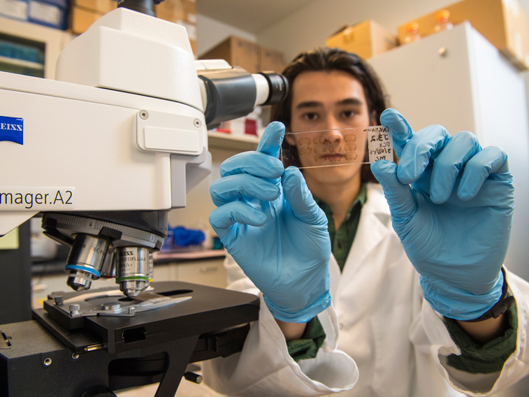 Psychology Department lab student studies the psychoneuroimmunology effects in mice brains.